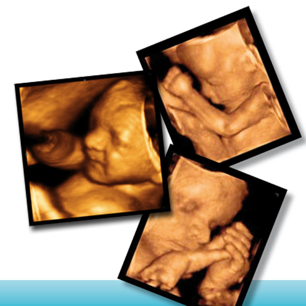 4d ultrahang képek 4d ultrahang képek